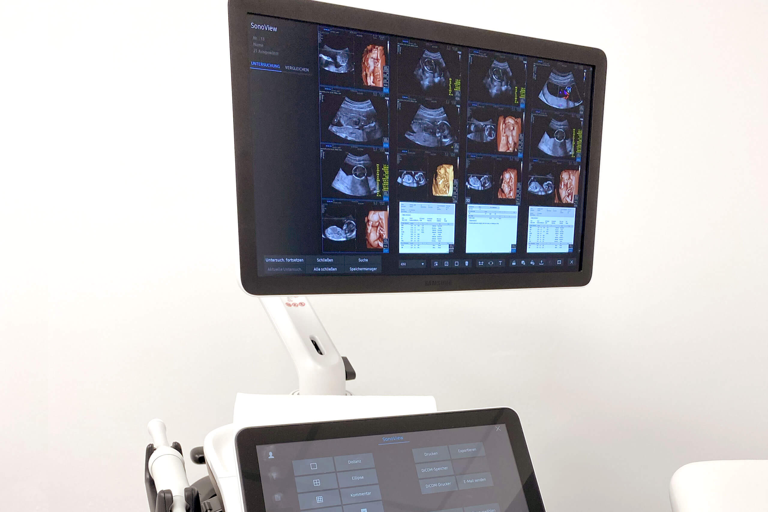 Ultraschall der Frauenarztpraxis in Essen Rüttenscheid